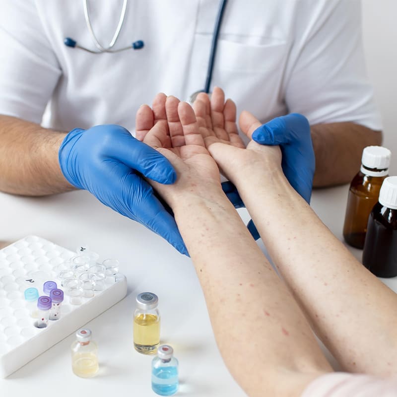 realizacion-de-pruebas-de-alergia-alergia-e-inmunologia-en-cdmx