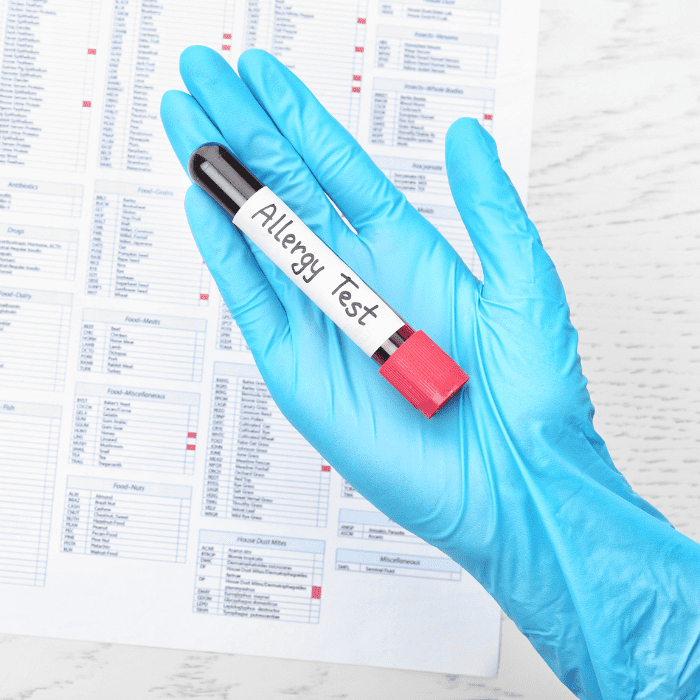 alergologo-especialista-en-hospital-angeles.png