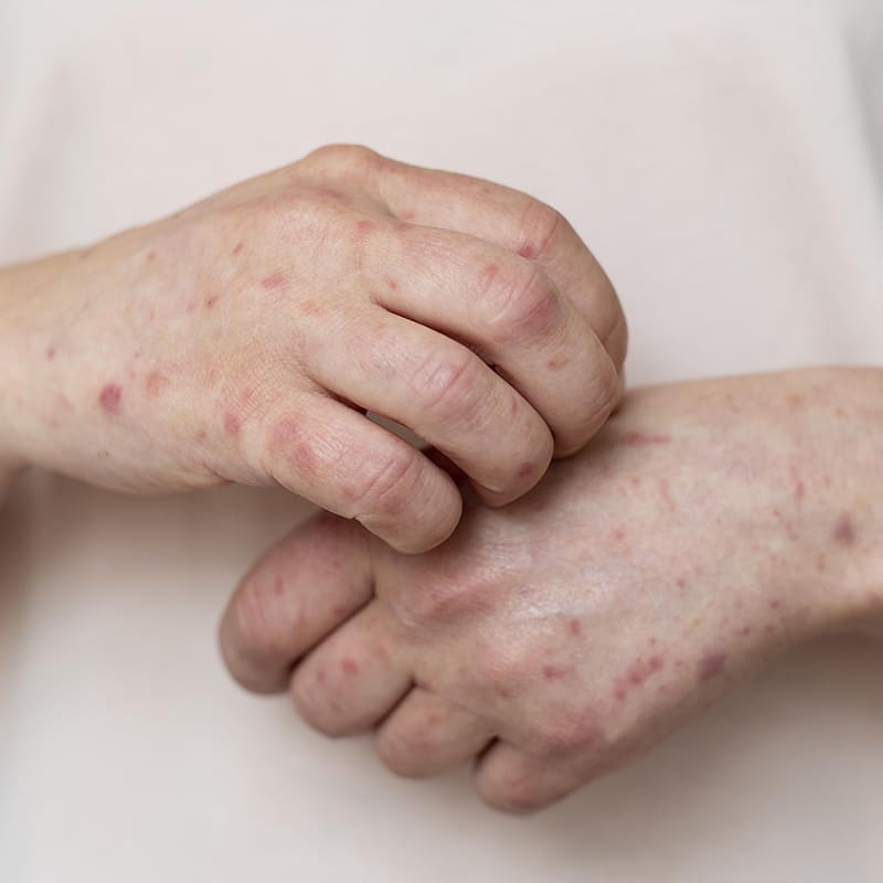 sin-amputaciones-especialista-en-pie-diabetico